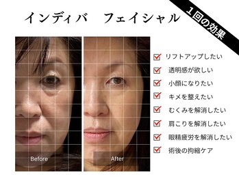 ラクレア(LA KULEA)の写真/インディバでハリツヤを整え小顔へ導くケア！肩こり眼精疲労の軽減も叶う♪結果が見える術後の凸凹ケア