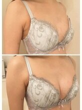 美人バスト 豊橋店/バストアップ症例【バストケア】