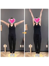 アーズ(A-Z)/痛みからの解放♪腕が軽～い！！