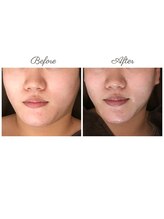 ウルエッテ(UluEtte)/フェイスラインがキュッと/福岡