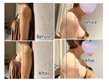 ミューズファクトリー(Muse factory)/巻肩・猫背の姿勢矯正やコリ改善