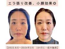 フェイススタンド 芦屋(FACE STAND)の雰囲気（【FACE STAND式 小顔矯正】頭.額から変わるバランスデザイン補正）
