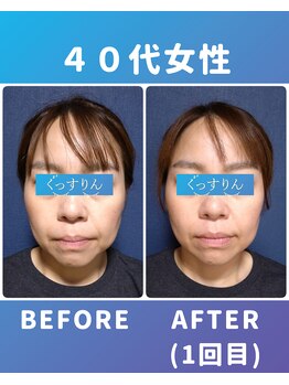 ぐっすりん/初回体験のお客様の変化(3)