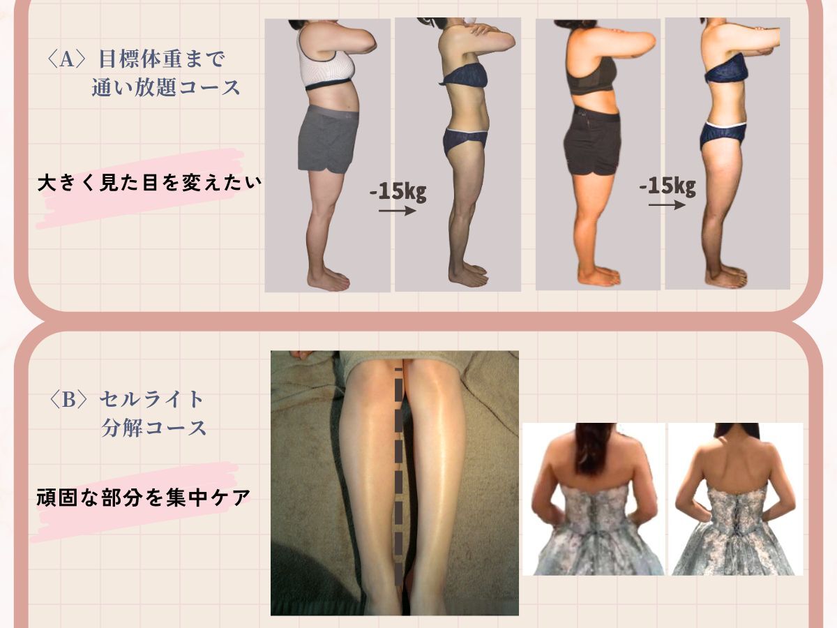 ビューティースリム リボーン 吉祥寺店(reborn)｜ホットペッパー