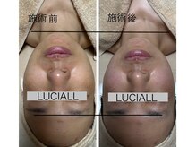 ルシアル(LUCIALL)/