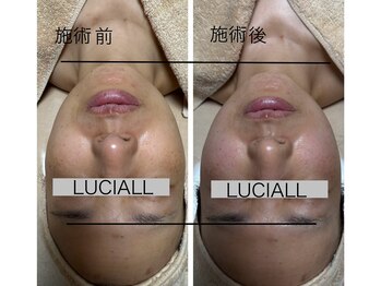 ルシアル(LUCIALL)/