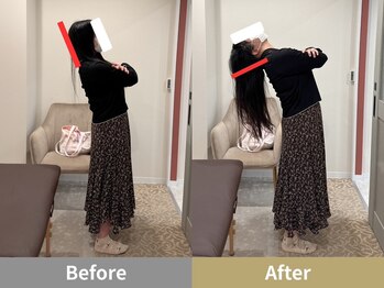 せなかのはね 井尻店/30代　肩こり　猫背　腰痛