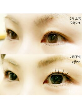 クレー(Klee)/パリジェンヌラッシュリフト