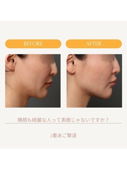 ミーティア(Meteor)/