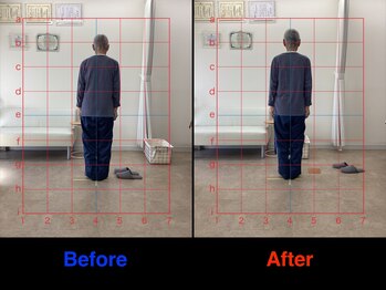 仁 久喜院(JIN)/#外反母指#足底筋膜#足底腱膜