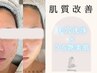 【35日以内再来★】毛穴洗浄ハイドラフェイシャル(スカルプケア付き)¥10,800