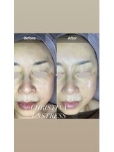 マリー(Mary.)/目じりや小鼻の赤みに