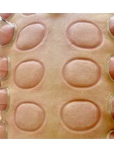 ビレイ(Birei)/カッピング