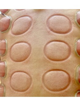 ビレイ(Birei)/カッピング