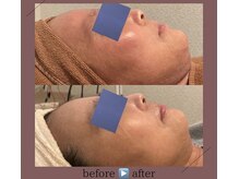 サロン ド ヴェール 四日市店(Salon de Vert)/乾燥/エイジング/エンビロン