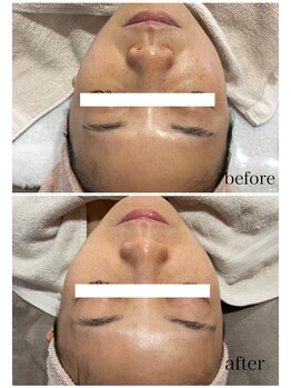 ジェイ(J)/韓国女優肌☆人気No.1ララピール