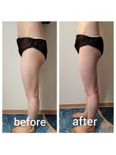 YOSAPARK Lulua/before＊after