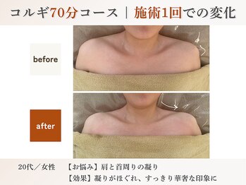 エルマ(elma)/コルギ70分before&after