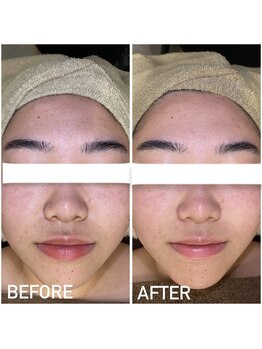 エステプリヴェモロッコ(ESTHE PRIVE MOROCCO)/BIOPHYTO 【毛穴/ザラつき】