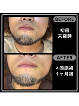 レイズ(Reyz)/