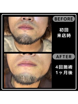 レイズ(Reyz)/
