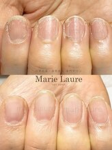 マリーロール 淀屋橋本店(Marie Laure)/自爪育成/深爪矯正/ネイルケア