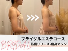 ミルズ(MillS)/ブライダルエステコース