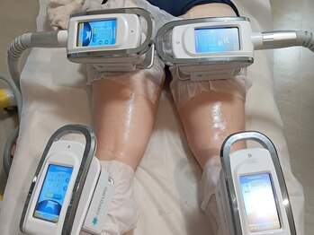 ホワイトビューティーラボ(White Beauty Lab)の写真/【気になる箇所をググっと引き締め♪】施術後の変化に感動…☆夏に向けて美ボディを目指しましょう！