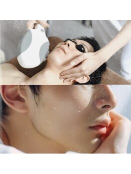 オアシス(OASIS)の写真/【理想のスベスベ肌へ！】IPL光フォト脱毛で毛穴引き締め＆保湿効果を実感できる♪自信ある素肌へ◎