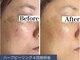 エルア 尼崎(Elua)の写真