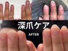 【初回限定】すぐ見た目が変わる【深爪ケア】人工爪で長さ出しクリアor自爪風