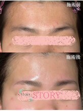 ストーリー(STORY)/眉毛と艶肌ワックス専門店