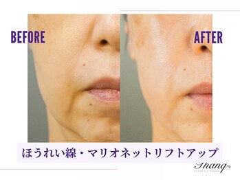 サンク(Thanq)/スマス筋&表情筋のトレーニング