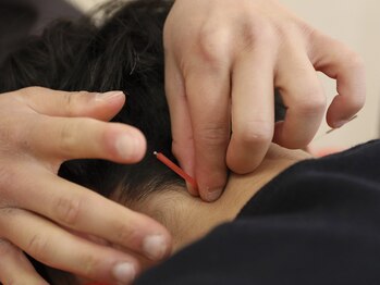 ほねつぎ つくば梅園はりきゅう接骨院/自律神経の乱れに鍼灸が◎