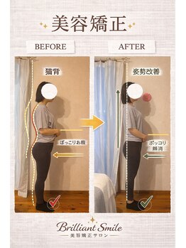 ブリリアントスマイル/猫背矯正で姿勢 ぽっこりお腹も