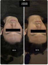 吉川美南ライフ整骨院/40代男性