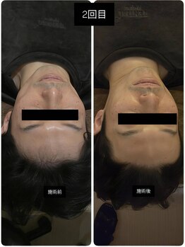 吉川美南ライフ整骨院/40代男性