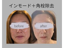 リズ(rE:S)の雰囲気（世界8000店舗以上でお取扱い韓国美容エステ専門コスメRe:bl取扱）
