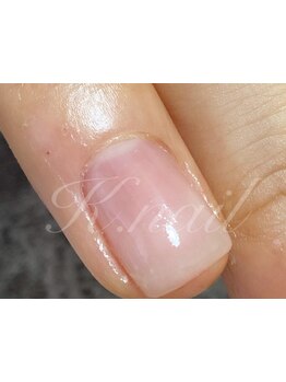 爪の悩みを解消できる（ケア含む）