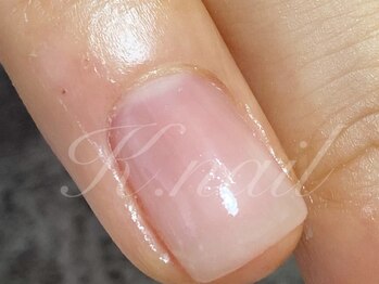 ケーネイル(K.nail)の写真/《深爪育成ができるサロン》隠したくなる爪から褒められ愛され爪へ・・・