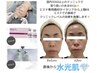 話題の肌質改善!水光艶美肌ピーリングWiQo＋デコルテヘッド!/毛穴/ハリ