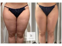 エムクリニカルラボ 藤沢(M clinical lab)の雰囲気（新メニュー「脂肪燃焼剤導入」で、気になる下半身を集中ケア◎）