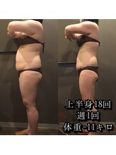 カルム エ コンポーゼ(Calme et Compose')/痩身セルゼロ／上半身18回