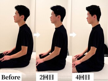 ソレア(Solea)/姿勢改善 Before/2回目/4回目