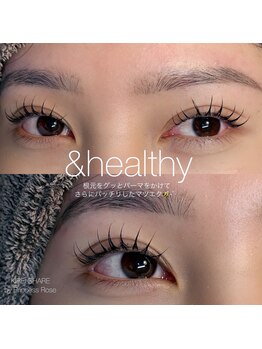 プリンセスローズ(Princess Rose)/バインドロック