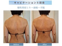 トータルビューティーサロンSHINE 【モイスティーヌ宗像】の雰囲気(背中・腰2部位キャビテーション¥7000→¥3500 ブライダルにも)