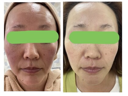 オリーブ(Olive)の写真