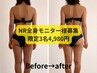 3名様限定【肩こり・むくみ・姿勢も整える♪】美姿勢☆全身モニター￥4,980