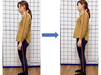 てぃ~だ/猫背を解消☆【王子駅/整体】