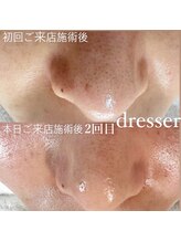 ドレッサー(Dresser)/話題の美容液で改善しなかった